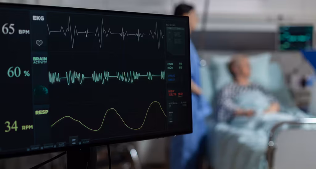 "Eletrocardiograma utilizado por cardiologista em São Paulo no diagnóstico cardíaco"
