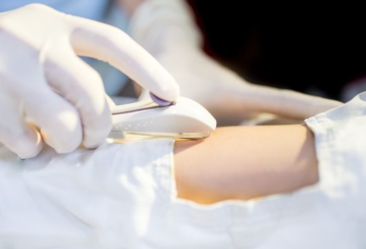 Tudo-sobre-implantes-hormonais-scaled