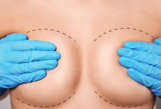 cirurgia-de-mama